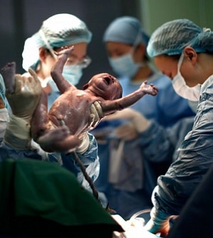Bebê recém-nascido na sala de parto