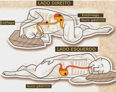 Ilustração dos benefícios de dormir sobre o lado esquerdo